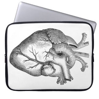 Einfache Schwarz-weiße Anatomie-Herz-Illustration Laptopschutzhülle