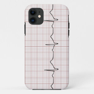 EKG Herzschlag auf Zeichenpapier mit title_seo2