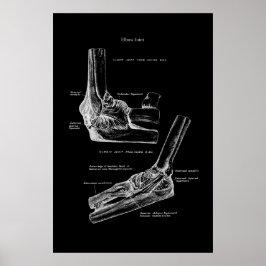 Elbow Joint Orthopädische Wanddekoration Poster