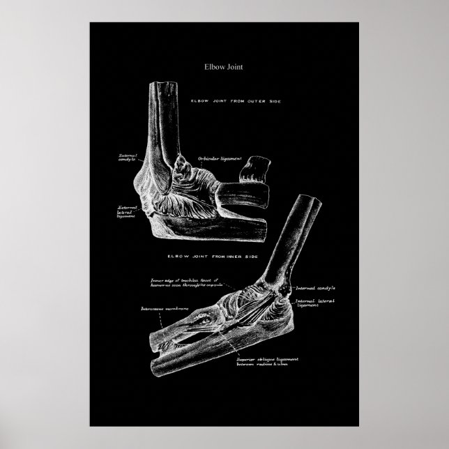 Elbow Joint Orthopädische Wanddekoration Poster (Vorne)