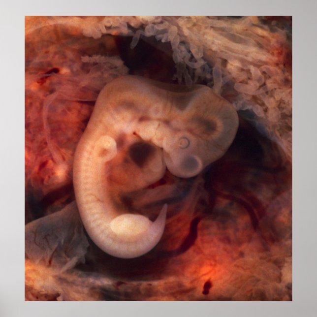 Embryo 7. Schwangerschaftswoche 5. Flüchtige Blick Poster (Vorne)