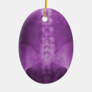 En Céramique Ornement pourpre d'art de rayon X de Digitals