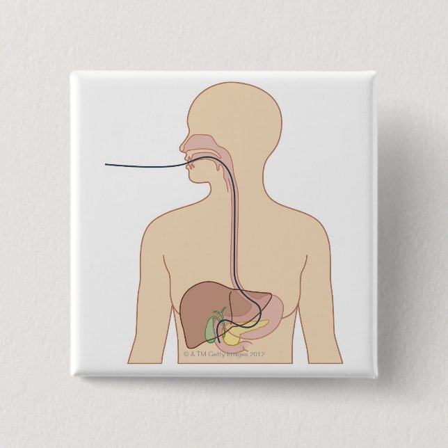 Endoskop Button (Vorderseite)