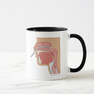 Endoskopie der Nase Tasse