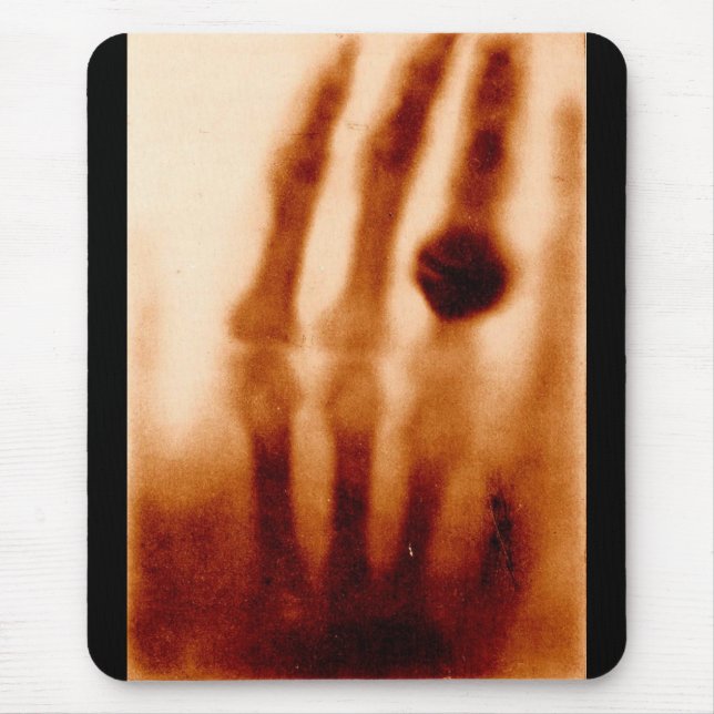 Erste X-Ray, 1901, Fotografie Mousepad (Vorne)