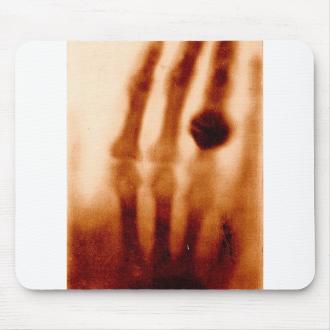 Erste X-Ray, 1901, Fotografie Mousepad (Vorne)