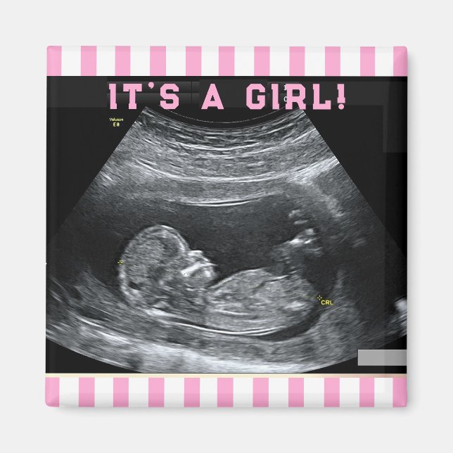 Erstes Foto des Babys Magnet (Vorne)