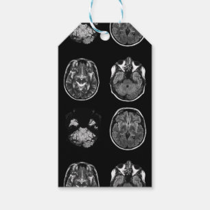 Étiquettes-cadeau Analyse IRM du cerveau