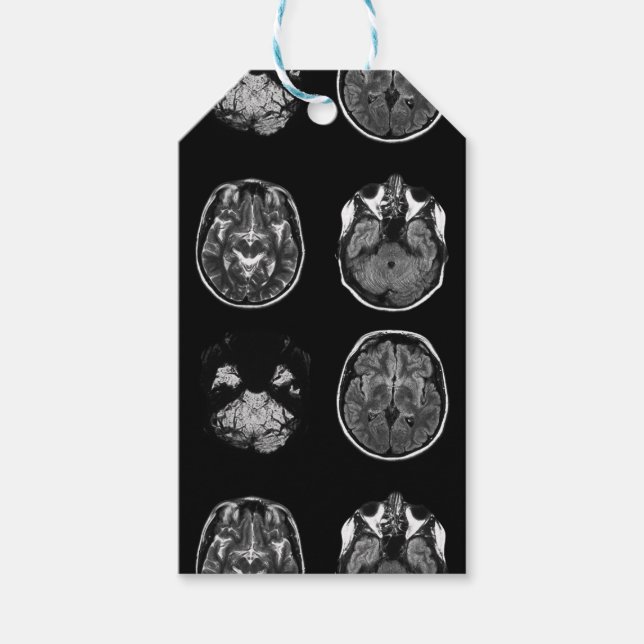 Étiquettes-cadeau Analyse IRM du cerveau (Devant)