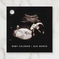 Grossesse Bébé Sonogramme Ultrasons Photo