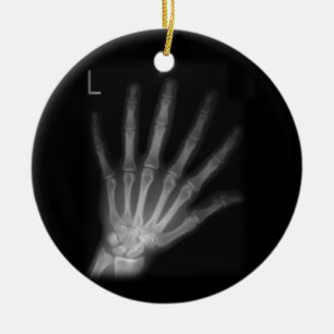 Extra Digit X-ray Left Hand Keramik Ornament