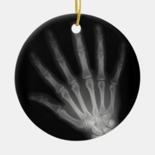 Extra Digit X-ray Left Hand Keramikornament