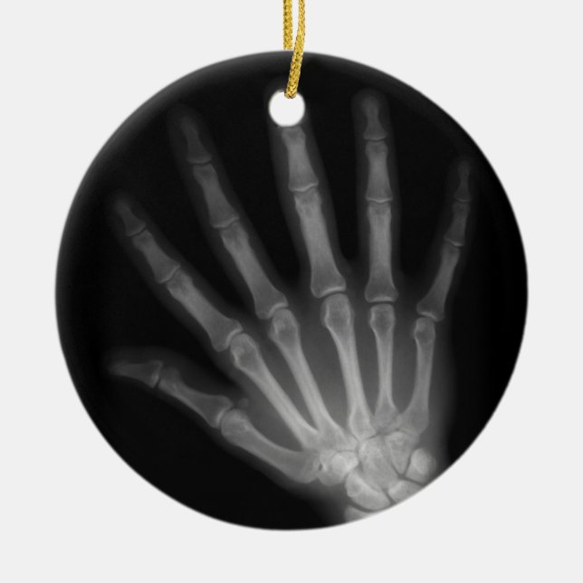 Extra Digit X-ray Left Hand Keramikornament (Vorne)