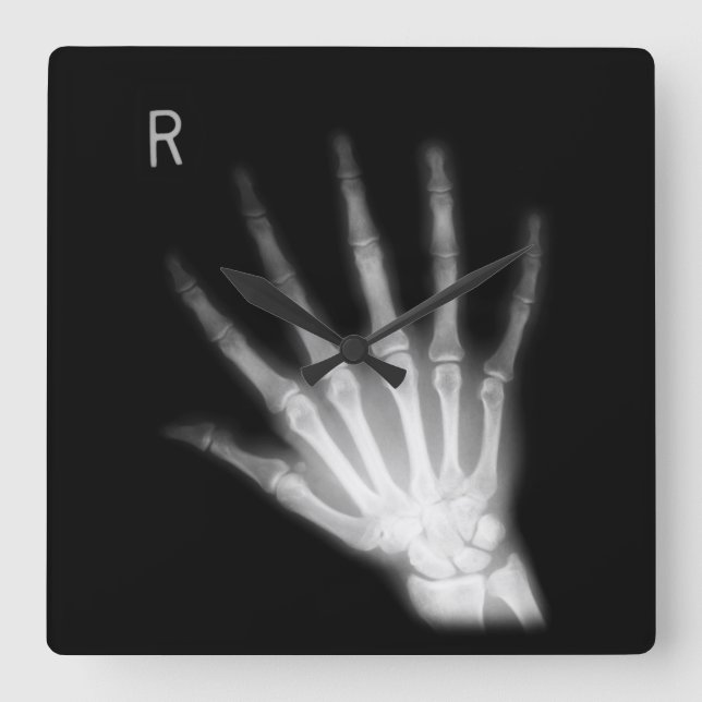 Extra Digit X-ray Right Hand Quadratische Wanduhr (Vorderseite)
