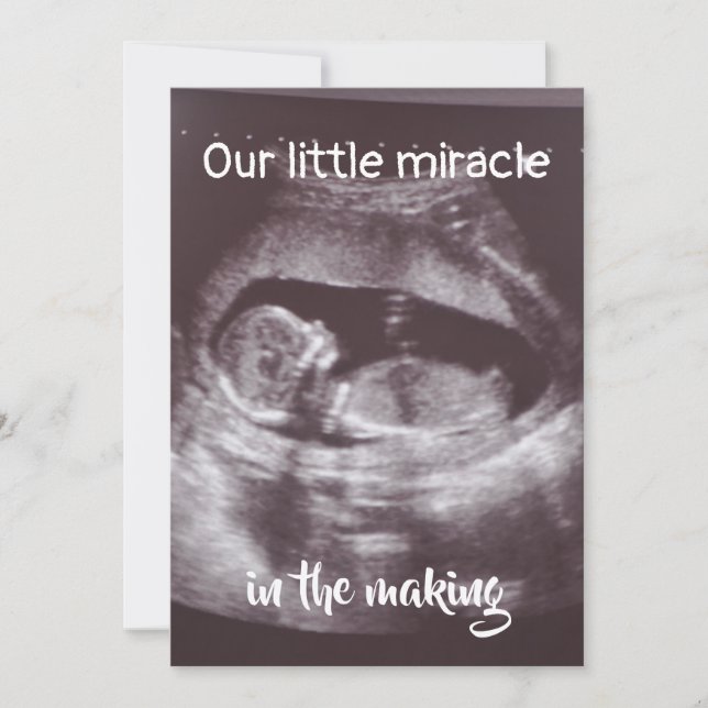 Faire-part Little Miracle Ultrasound 2 Photo Baby Family (Devant)