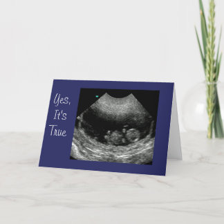 Faire-part Nouveau bébé Anouncement