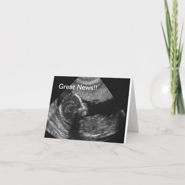 Faire-part Nouvel ultrason de bébé (Devant)
