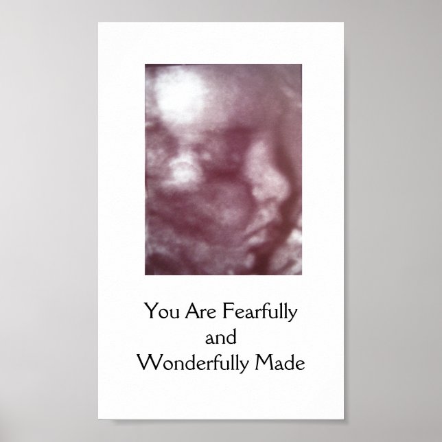 Fearful and Wonderful Fade / Poster (Devant)