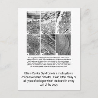 Fehlerhafte Kollagen EDS-Bewusstseins-Postkarte Postkarte