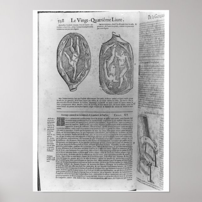 Fetus, Illustration von "Oeuvres" Poster (Vorne)