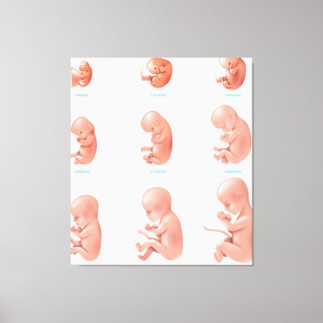 Fetus Leinwanddruck (Vorderseite)
