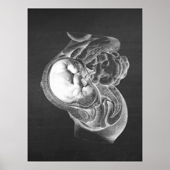Fetus Womb Anatomy Obstetrics Deco Nr. 2 Poster (Vorne)
