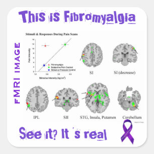 Fibromyalgia ist wirklich. Sie können ihn auf Quadratischer Aufkleber