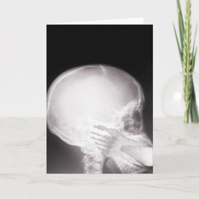Foot in Mouth X-Ray Karte (Vorderseite)