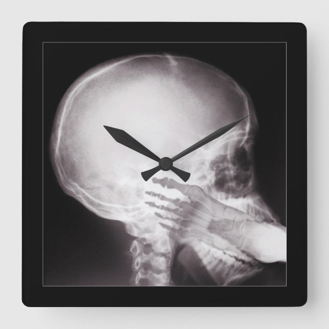 Foot in Mouth X-Ray Quadratische Wanduhr (Vorderseite)