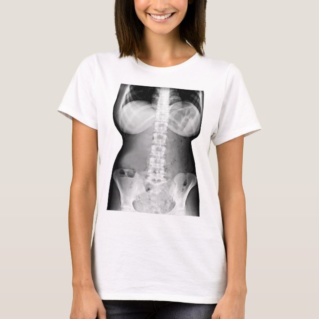 Foto-Abbildung T-Shirt (Vorderseite)