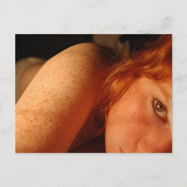 Freckles Postkarte (Vorderseite)