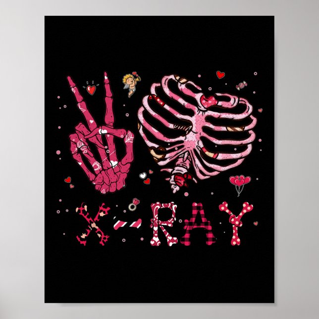 Friedensliebe Röntgen Valentinstag  Poster (Vorne)