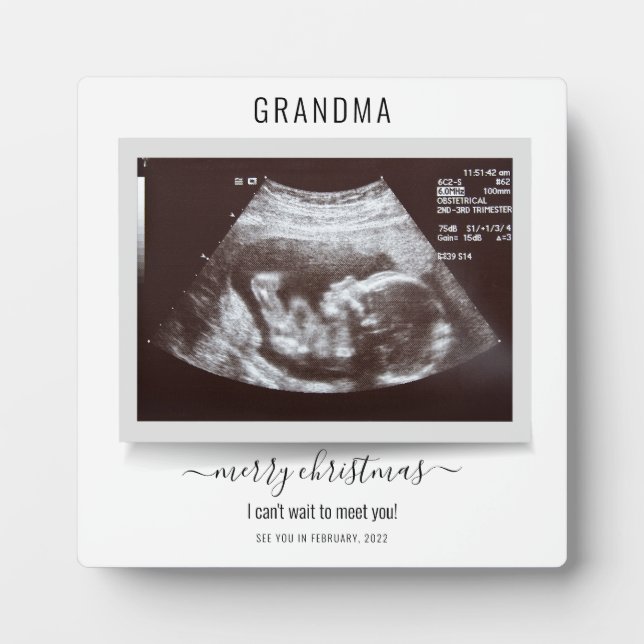 Frohe Weihnachten Ultrasound Foto Schwangerschaft Fotoplatte (Vorderseite)