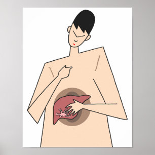 Früherkennung von Lebererkrankungen. Poster