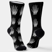 Fun Polydactyl Hand Radiograph