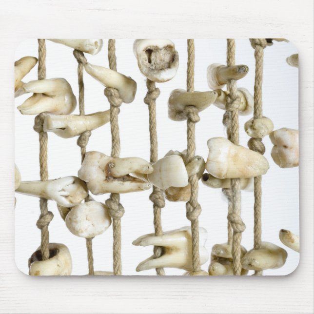 Funny Dental Fotografy Extracted Zähne Zahnarzt Mousepad (Vorne)