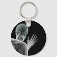 Funny Xray Photobomb