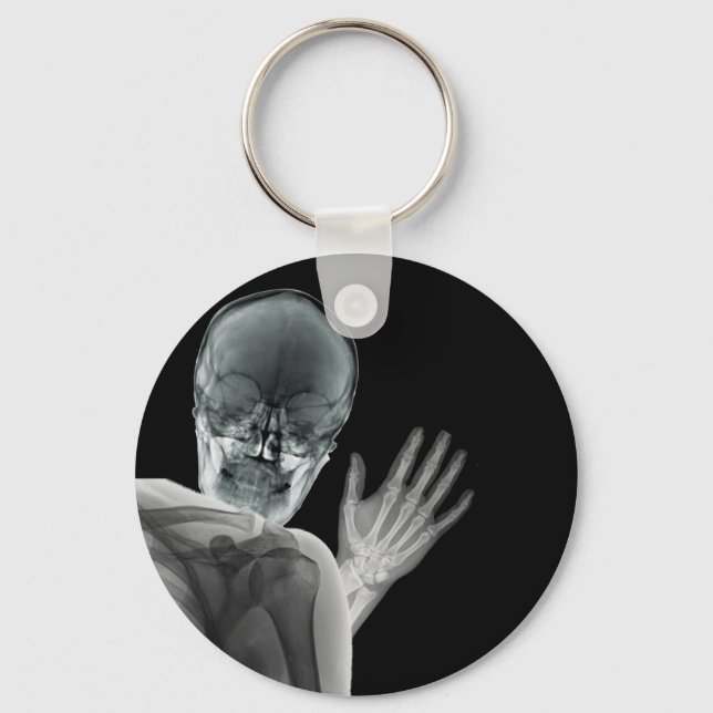 Funny Xray Photobomb Schlüsselanhänger (Vorderseite)