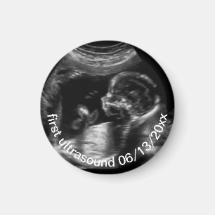 Für Neugeborene: First Ultrasound Sonogram Baby Magnet