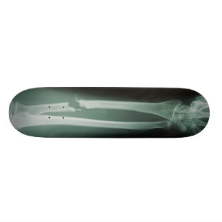Gebrochene Knochen Skateboard