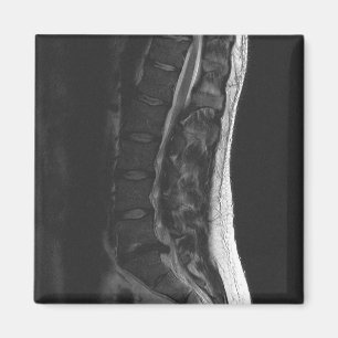 Gebrochener Disc-Magnet Magnet