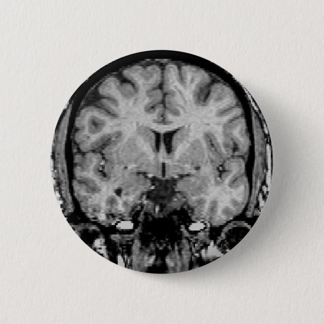Gehirn MRI, Kranzscheibe Button (Vorderseite)