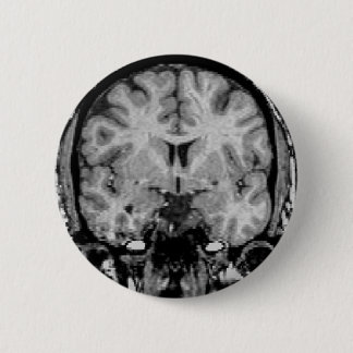 Gehirn MRI, Kranzscheibe Button