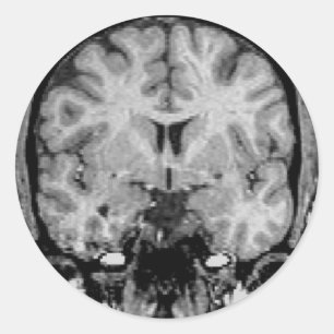 Gehirn MRI, Kranzscheibe Runder Aufkleber
