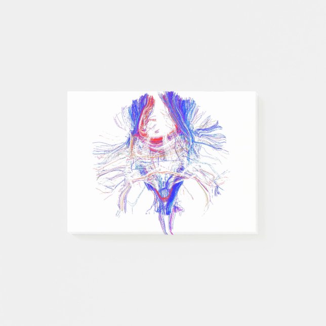 Gehirn und Tracktography Post-it Klebezettel (Vorderseite)