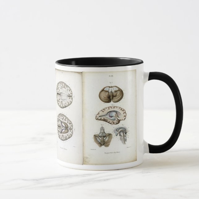 Gehirnanatomie-Druck-Tasse Tasse (Rechts)