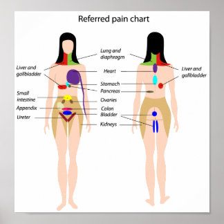 Gezieltes Schmerzdiagramm Poster