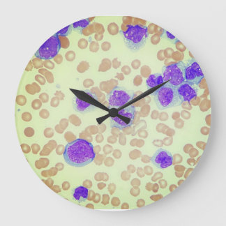 Grande Horloge Ronde Laboratoire d'hématologie du microscope à diaposit