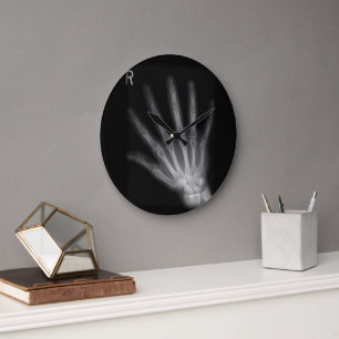 Grande Horloge Ronde Rayon X du doigt supplémentaire main droite