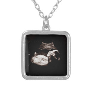 Grossesse Baby Ultrasound Sonogramme Collier photo